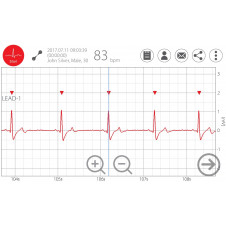 Weterynaryjne EKG BT jednoodprowadzeniowe