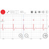 Weterynaryjne EKG BT jednoodprowadzeniowe